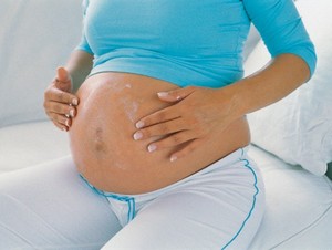 как предотвратить растяжки во время беременности